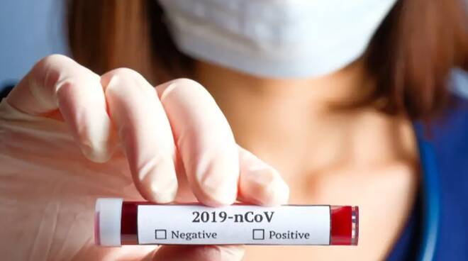 Coronavirus, situazione peggiora: 79 morti, 2263 contagiati, 160 guariti
